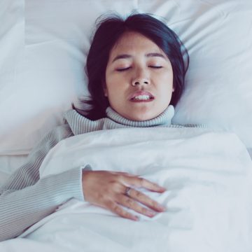 What is Bruxism (Teeth Grinding): Causes, Symptoms & Treatment Options