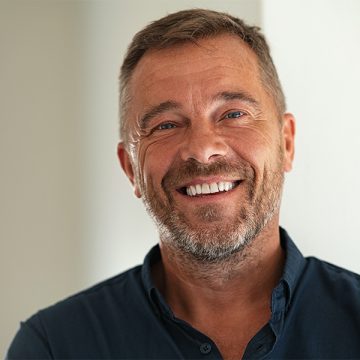 What is Dental Bonding: Procedure, Advantages & Aftercare Tips