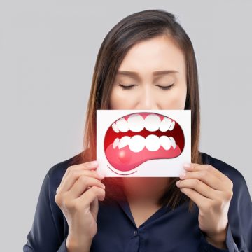 What is Periodontal (Gum) Disease: Causes, Signs & Treatment Options
