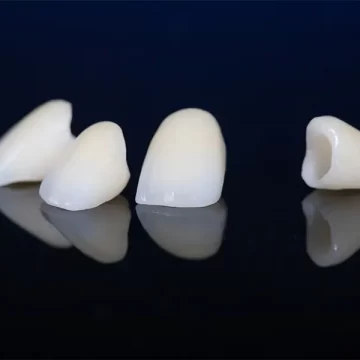 Dental Crowns: A Reliable Solution for Discolored or Uneven Teeth